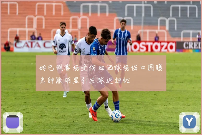 姆巴佩赛场受伤血洒球场伤口图曝光肿胀明显引发球迷担忧